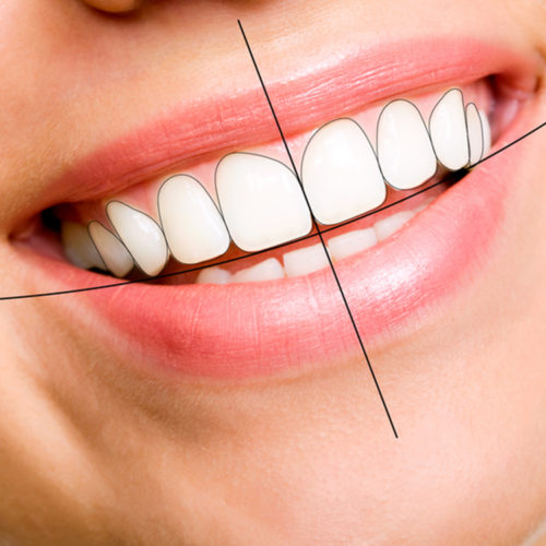 Estetik Gülüş Tasarımı