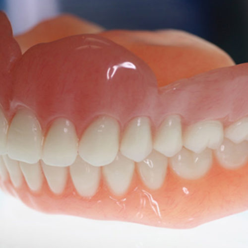 Protez Diş Tedavisi